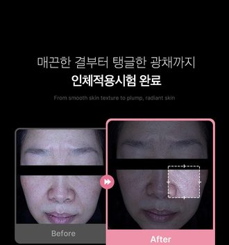 상세 47